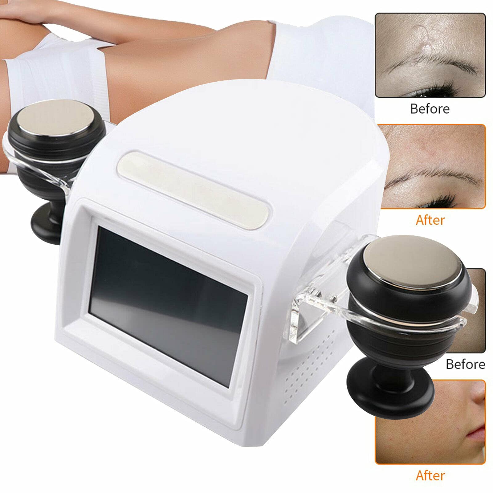 Dispositif de Beauté Radiofréquence avec Massage sous Vide Cavitation Ultrasonique 